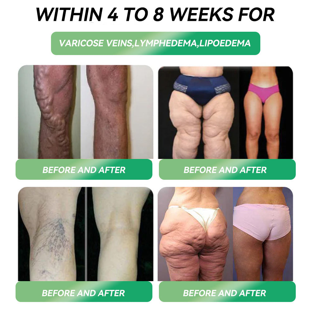 【🇬🇧𝐋𝐚𝐬𝐭 𝐃𝐚𝐲 – 𝟖𝟎% 𝐎𝐟𝐟 】🌿𝐏𝐄𝐀𝐊𝐀® 𝐆𝐋𝐏-𝟏 𝐒𝐢𝐱-𝐢𝐧-𝐎𝐧𝐞 𝐇𝐞𝐚𝐥𝐭𝐡 𝐒𝐨𝐥𝐮𝐭𝐢𝐨𝐧 𝐎𝐫𝐚𝐥 𝐋𝐢𝐪𝐮𝐢𝐝 (𝐉𝐮𝐬𝐭 𝐨𝐧𝐞 𝐝𝐨𝐬𝐞 𝐚 𝐝𝐚𝐲 — 𝐯𝐢𝐬𝐢𝐛𝐥𝐞 𝐫𝐞𝐬𝐮𝐥𝐭𝐬 𝐢𝐧 𝐣𝐮𝐬𝐭 𝟕 𝐝𝐚𝐲𝐬) ✅ 𝐅𝐨𝐫 𝐨𝐛𝐞𝐬𝐢𝐭𝐲, 𝐜𝐚𝐫𝐝𝐢𝐨𝐯𝐚𝐬𝐜𝐮𝐥𝐚𝐫 𝐡𝐞𝐚𝐥𝐭𝐡, 𝐝𝐢𝐚𝐛𝐞𝐭𝐞𝐬, 𝐬𝐥𝐞𝐞𝐩 𝐚𝐩𝐧𝐨𝐞𝐚, 𝐣𝐨𝐢𝐧𝐭 𝐢𝐬𝐬𝐮𝐞𝐬, 𝐚𝐧𝐝 𝐦𝐨𝐫𝐞